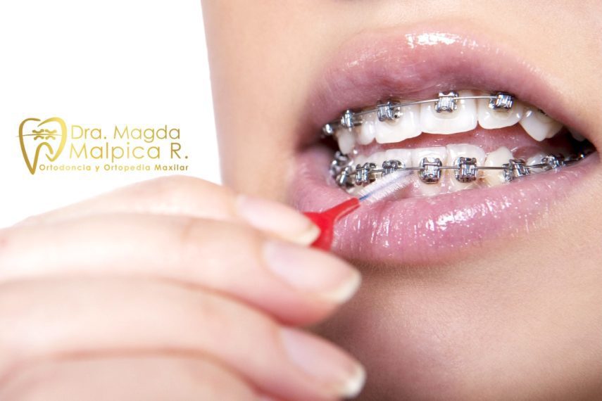magda malpica ortodoncia-ortopedia maxilar sabanalarga 3