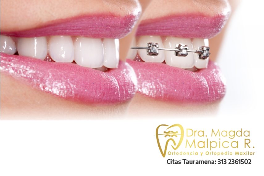 magda malpica ortodoncia-ortopedia maxilar tauramena 1